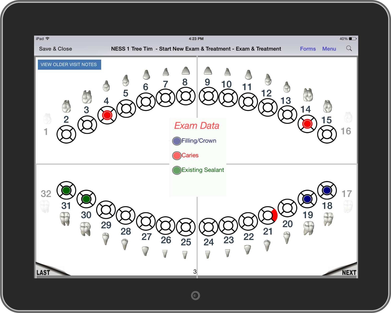 Tablet Dental Charting